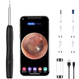 Wolady Otoscopio Endoscopio para Oidos Camara 1600P WIFI Limpiador de Oidos con...